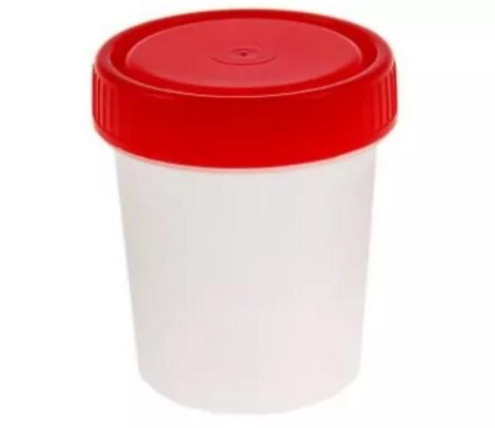 Ємність для забору сечі 120 мл стерильна ТМ "OK Pharma"